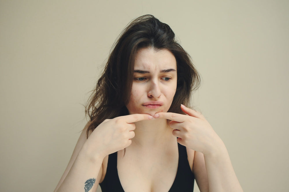 Acne in gravidanza e allattamento: Cause e rimedi